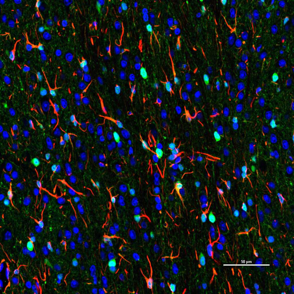 胶质纤维酸性蛋白重组兔单抗