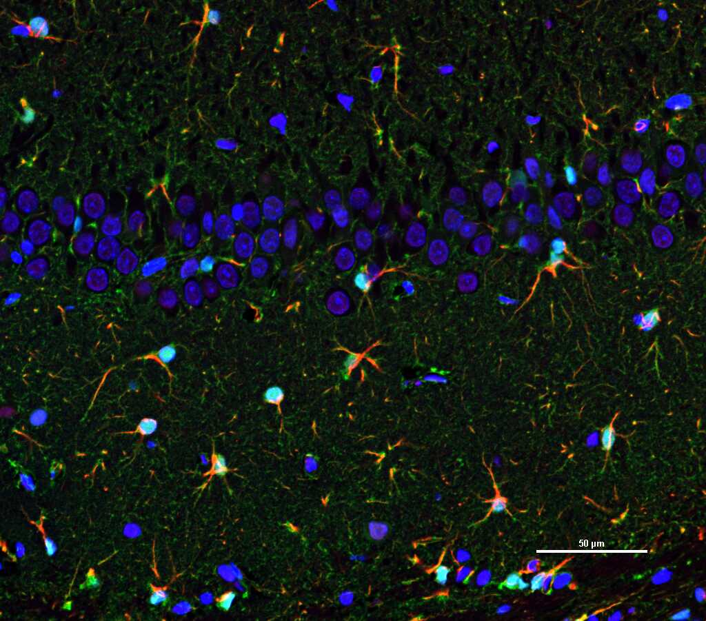 S100B Mouse mAb (一抗) - WB,IHC-P,IHC-F,IF,Flow-Cyt | Bioss