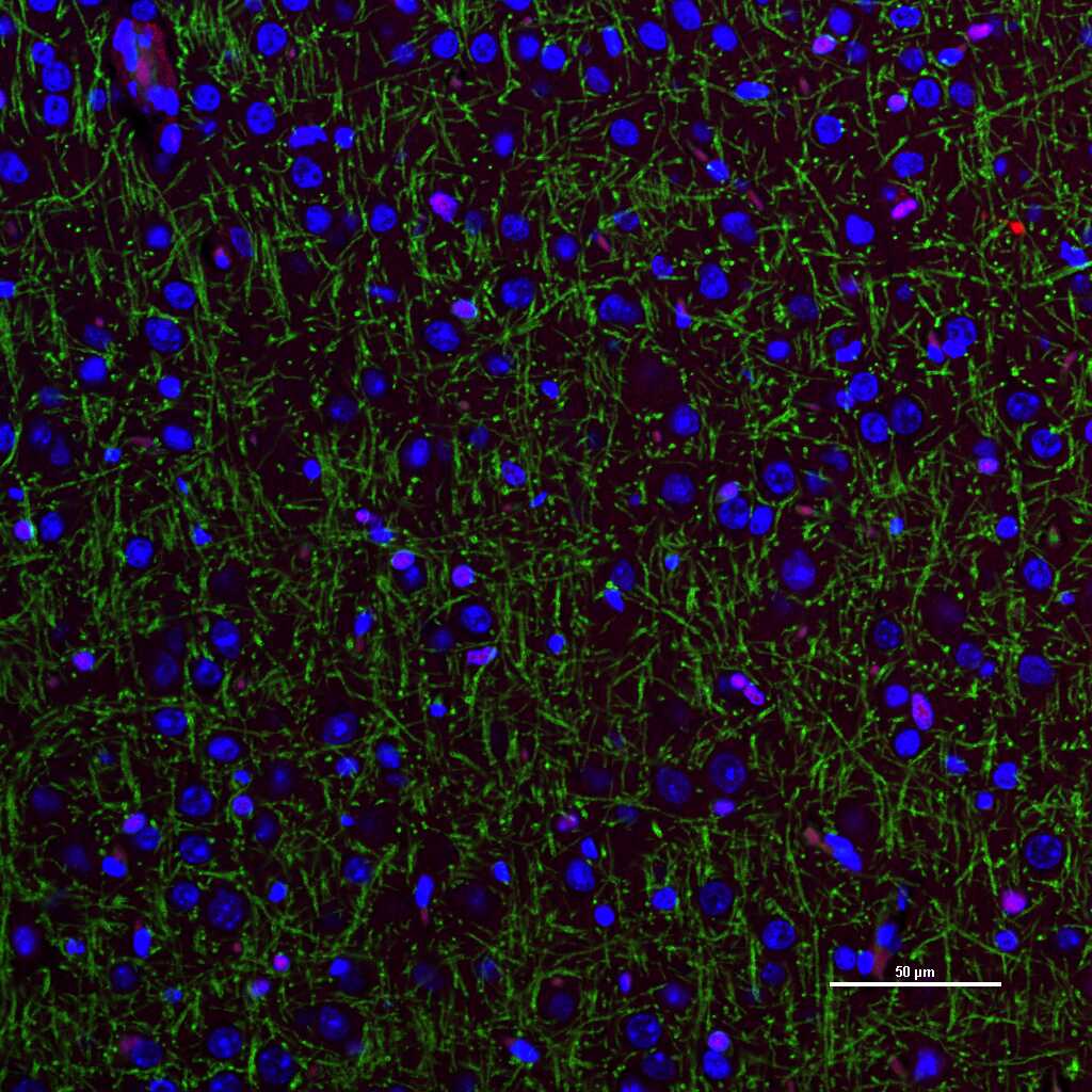 少突胶质细胞转录因子2重组兔单抗