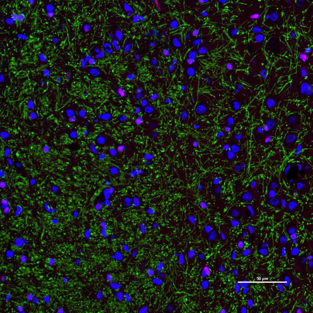 髓鞘碱性蛋白/磷脂碱性蛋白单克隆抗体-bsm-33932M