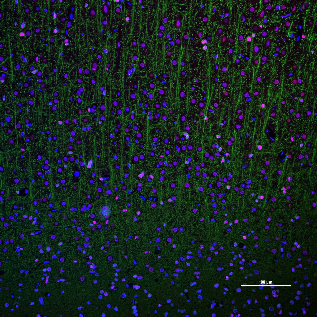 少突胶质细胞转录因子2重组兔单抗