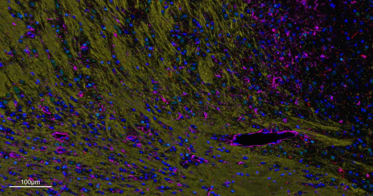 少突胶质细胞转录因子2重组兔单抗