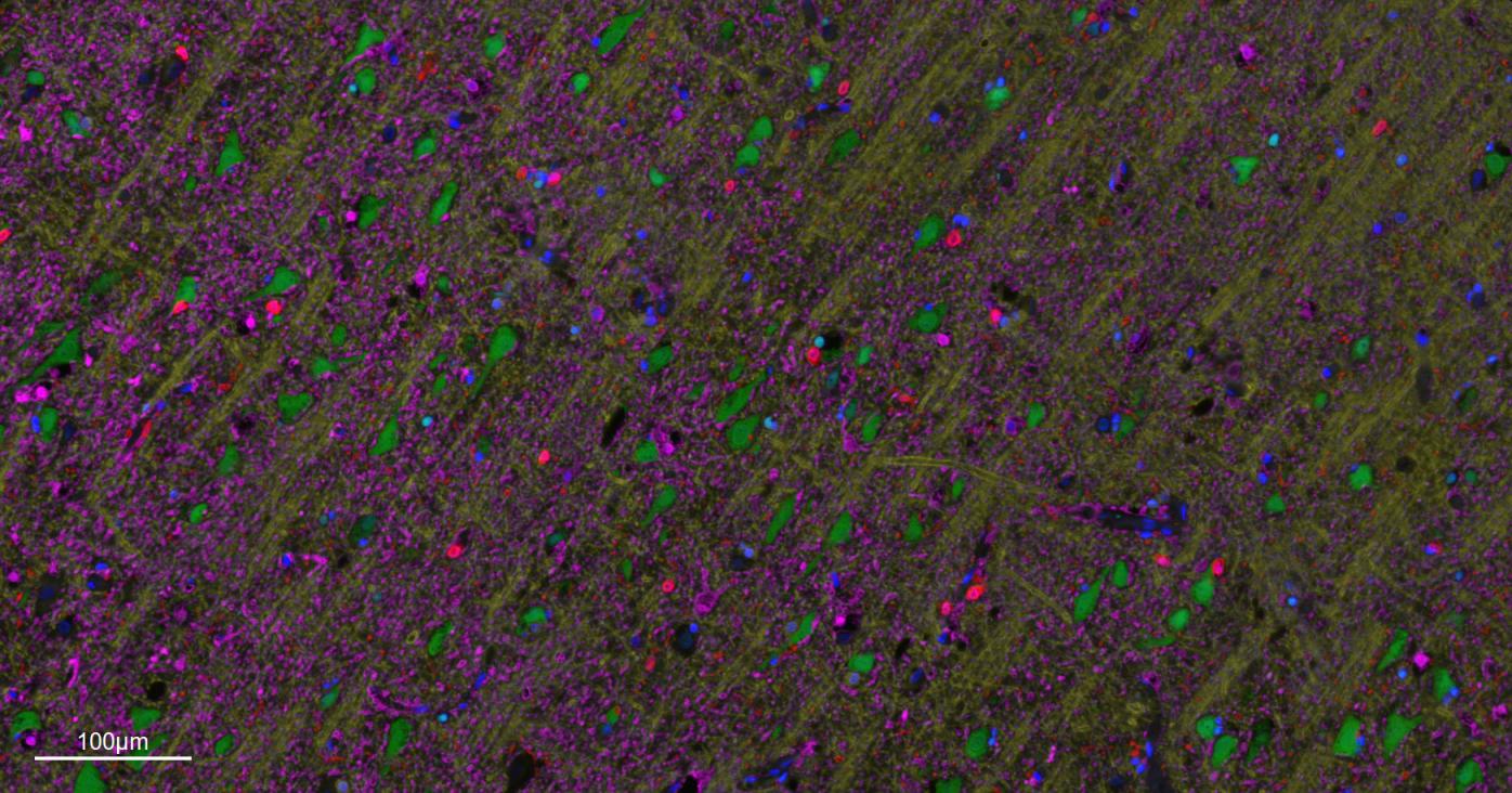 少突胶质细胞转录因子2重组兔单抗