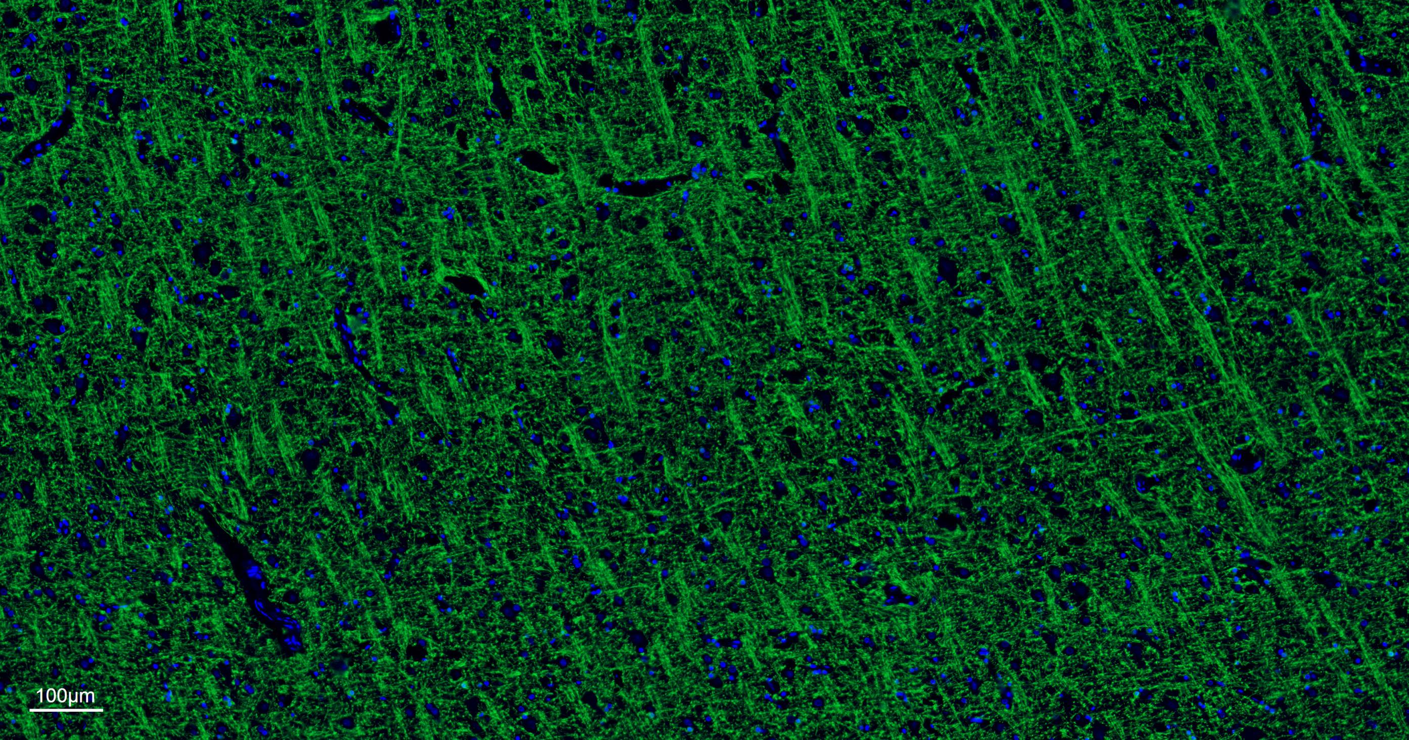 髓鞘碱性蛋白/磷脂碱性蛋白单克隆抗体-bsm-33932M