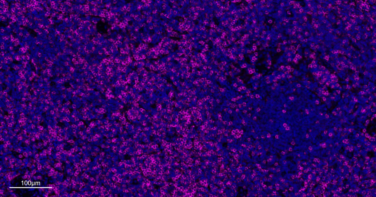 CD8A单克隆抗体-bsm-34251M