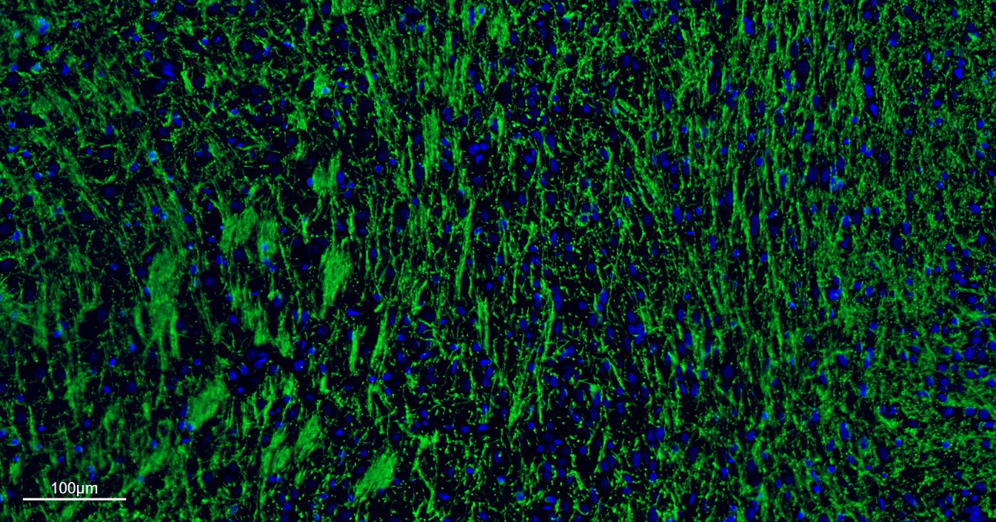髓鞘碱性蛋白/磷脂碱性蛋白单克隆抗体-bsm-33932M