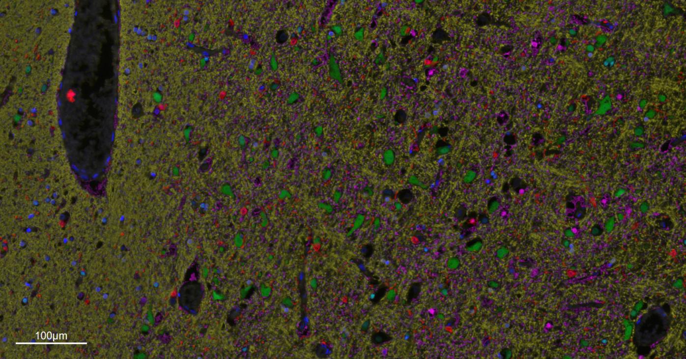 离子钙接头蛋白单克隆抗体-bsm-54132R