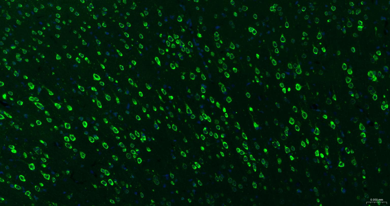 糖原合酶激酶-3β重组兔单抗