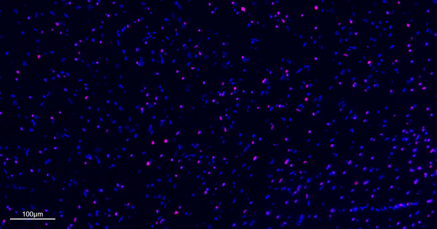 少突胶质细胞转录因子2重组兔单抗