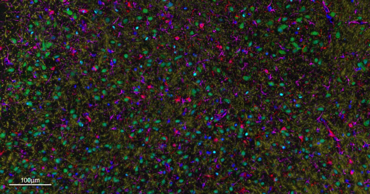 胶质纤维酸性蛋白重组兔单抗