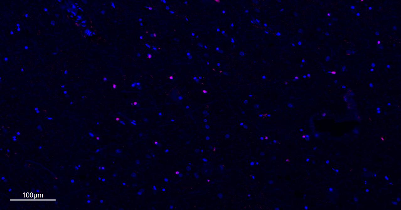 少突胶质细胞转录因子2重组兔单抗