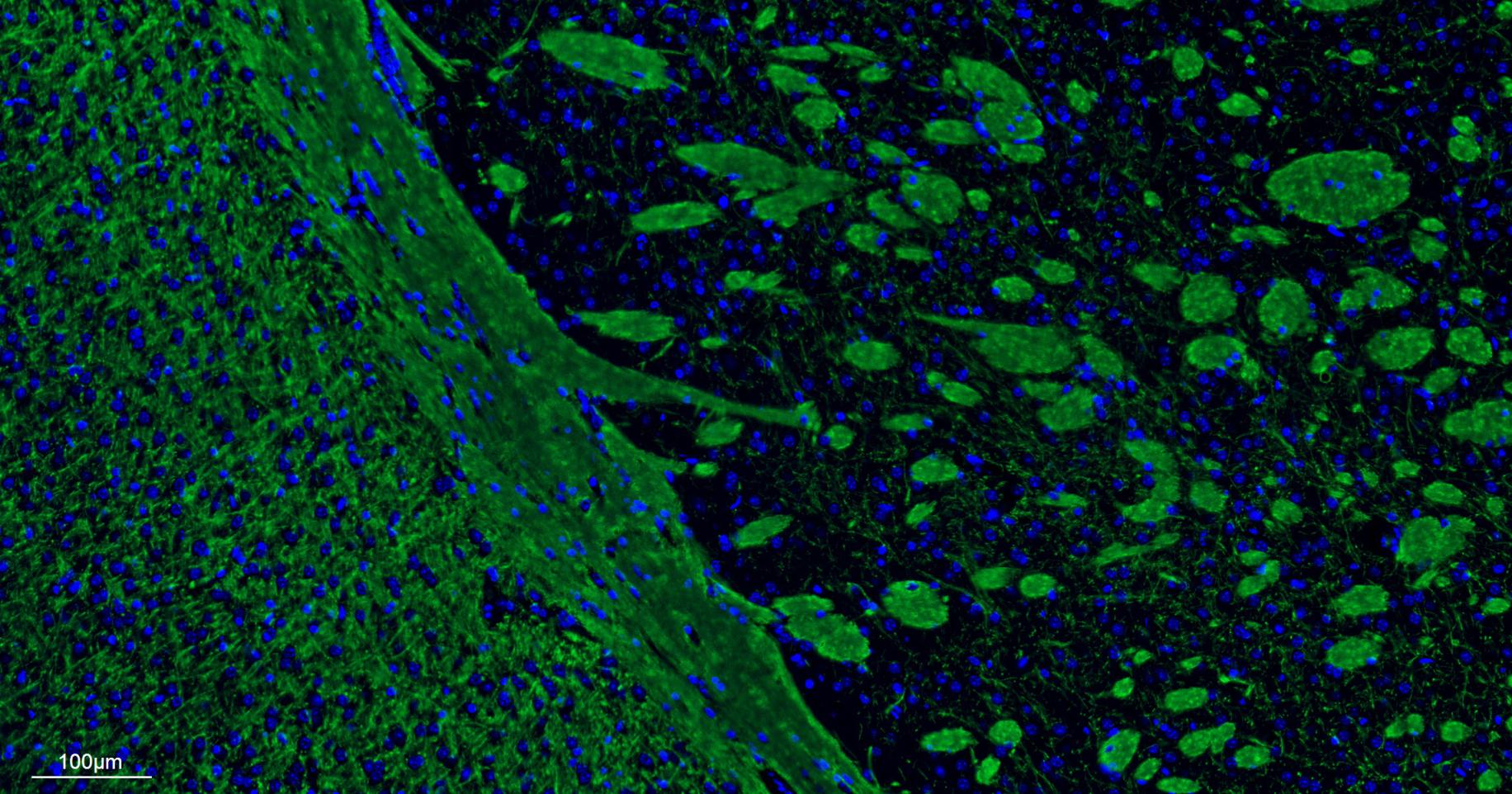 髓鞘碱性蛋白/磷脂碱性蛋白单克隆抗体-bsm-33932M