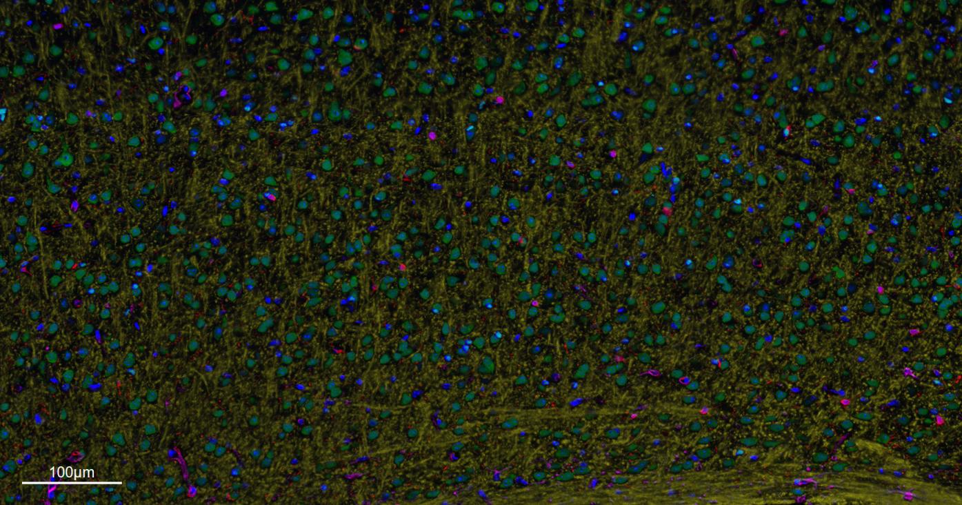 神经元核抗原重组兔单抗