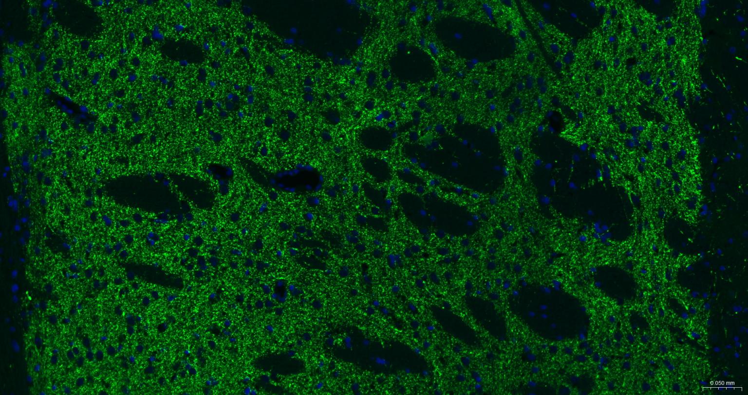 酪氨酸羟化酶兔单克隆抗体