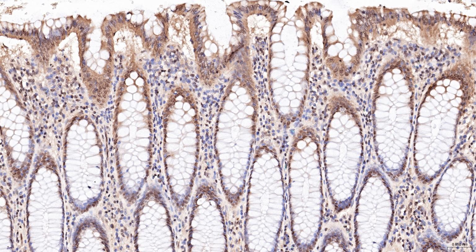 细胞死亡活化蛋白抗体-bs-6796R