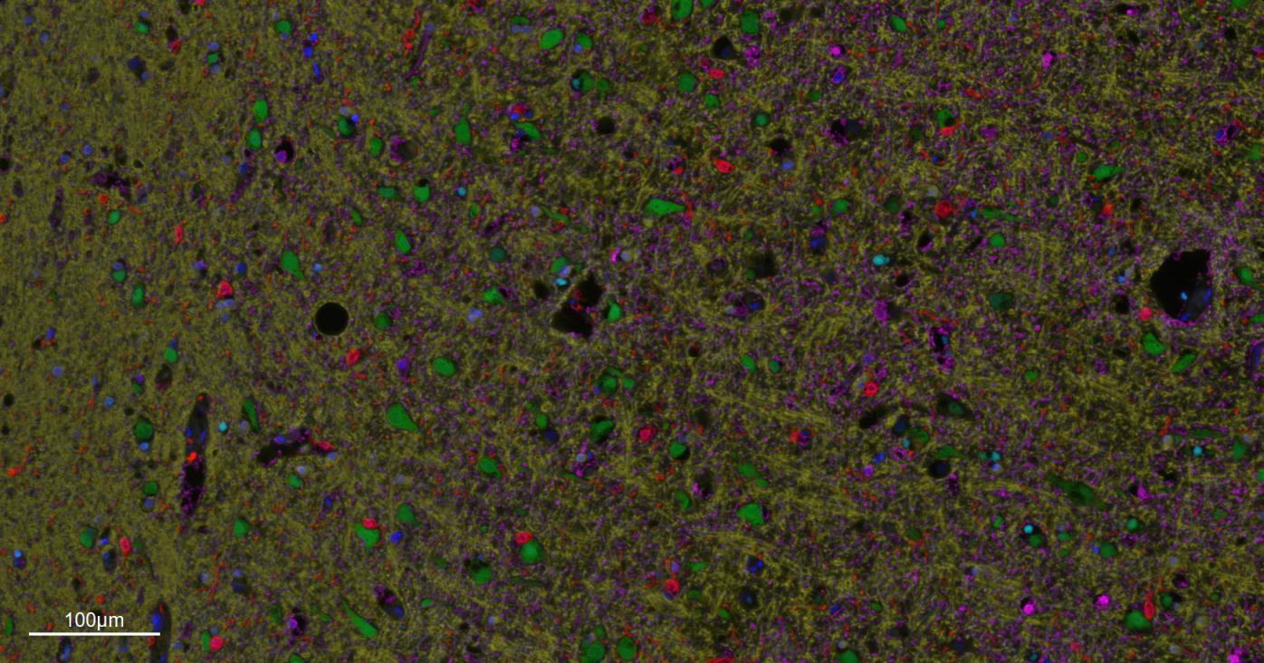 神经元核抗原重组兔单抗