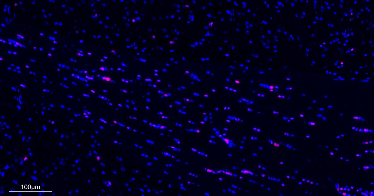 少突胶质细胞转录因子2重组兔单抗