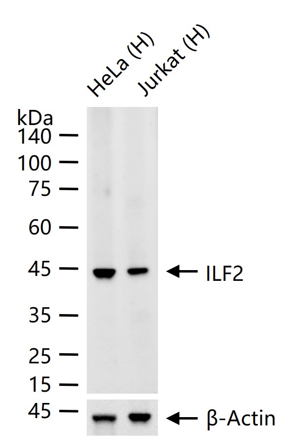白细胞介素增强子结合因子2重组兔单抗