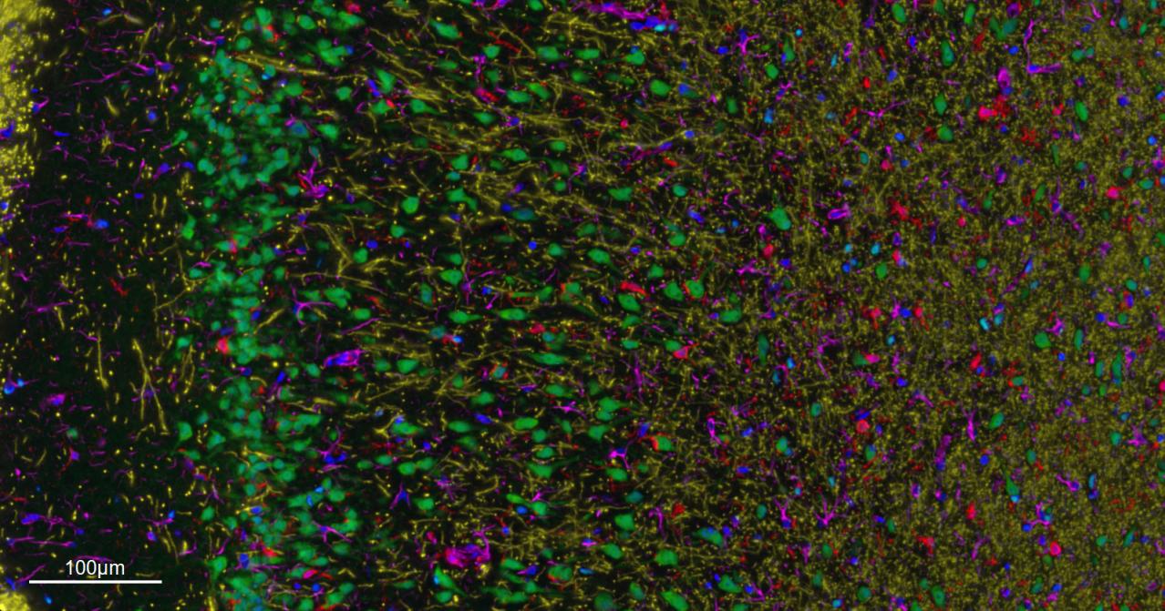 髓鞘碱性蛋白/磷脂碱性蛋白单克隆抗体-bsm-33932M