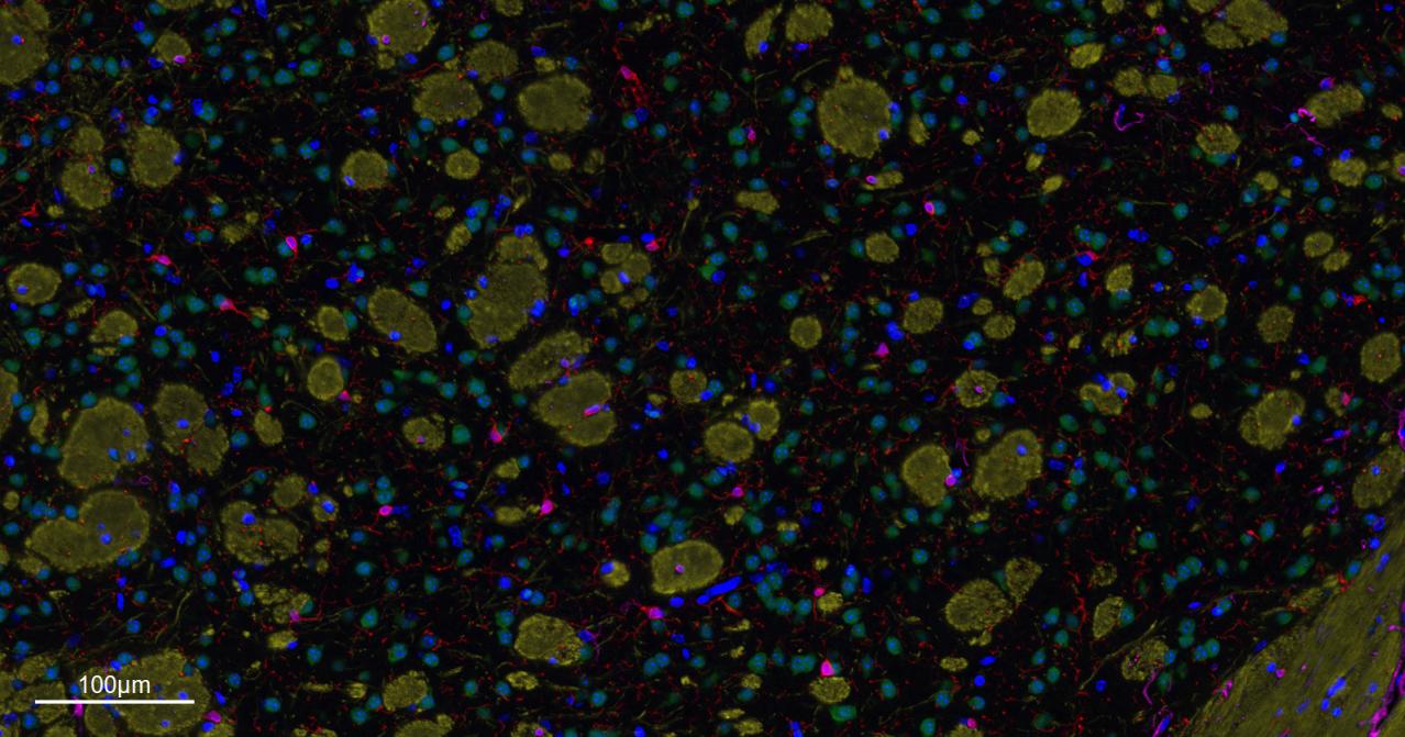 离子钙接头蛋白单克隆抗体-bsm-54132R