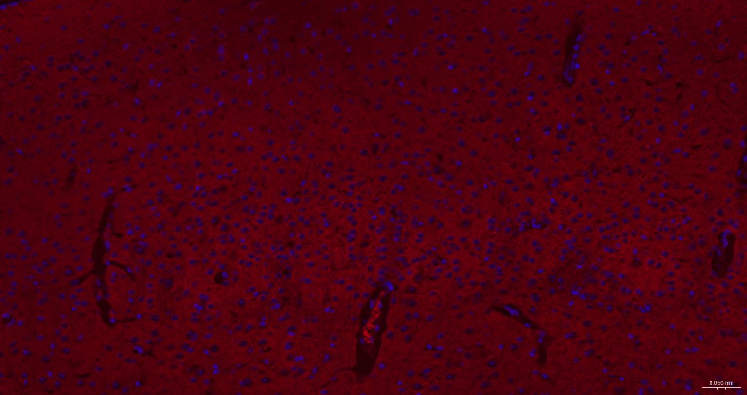 酪氨酸激酶A/B/C重组兔单抗-bsm-52715R