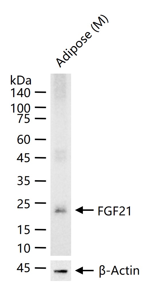 成纤维细胞生长因子21重组兔单抗