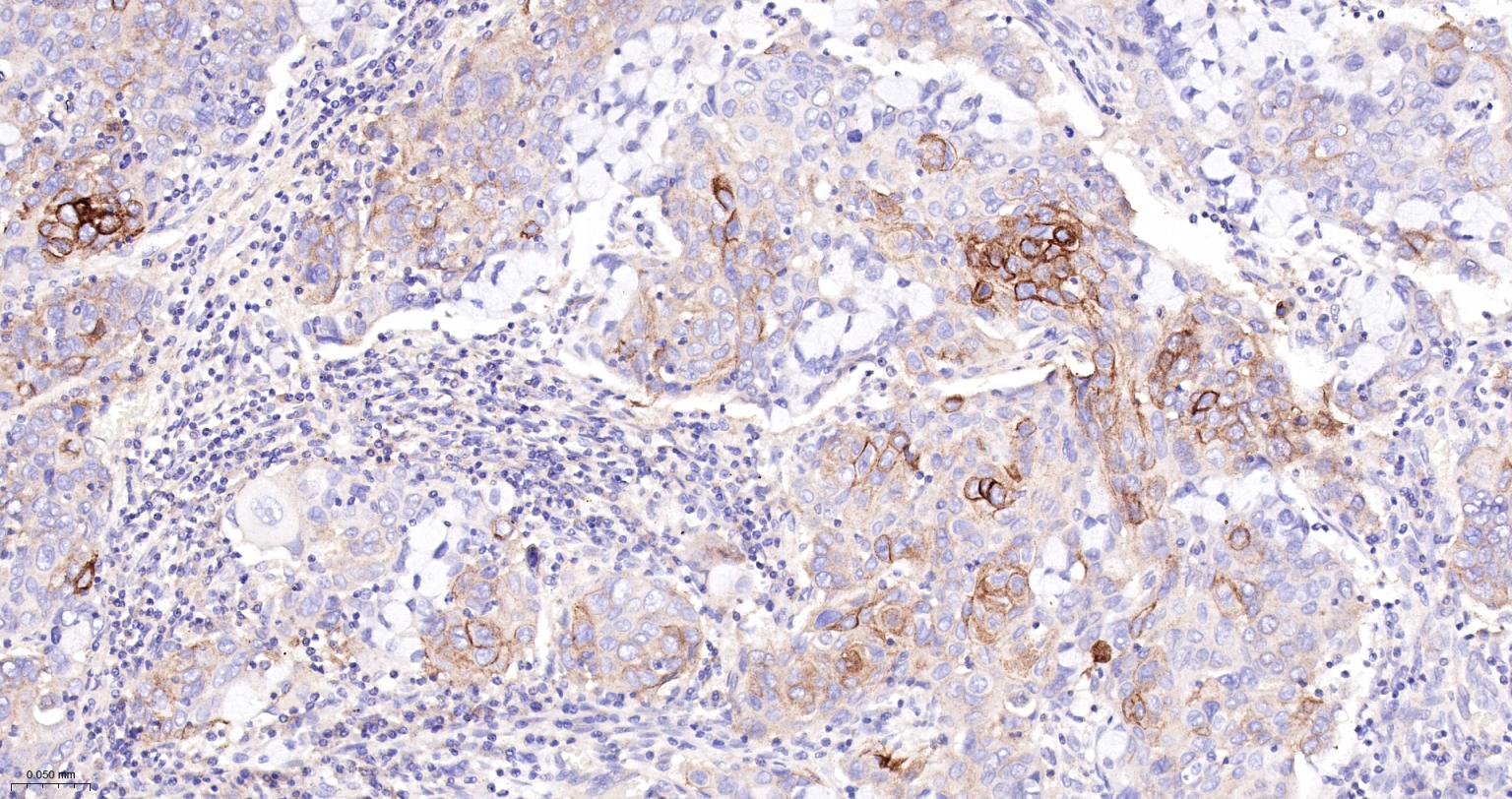 钠/钾转运 ATP 酶亚基 beta-3重组兔单抗