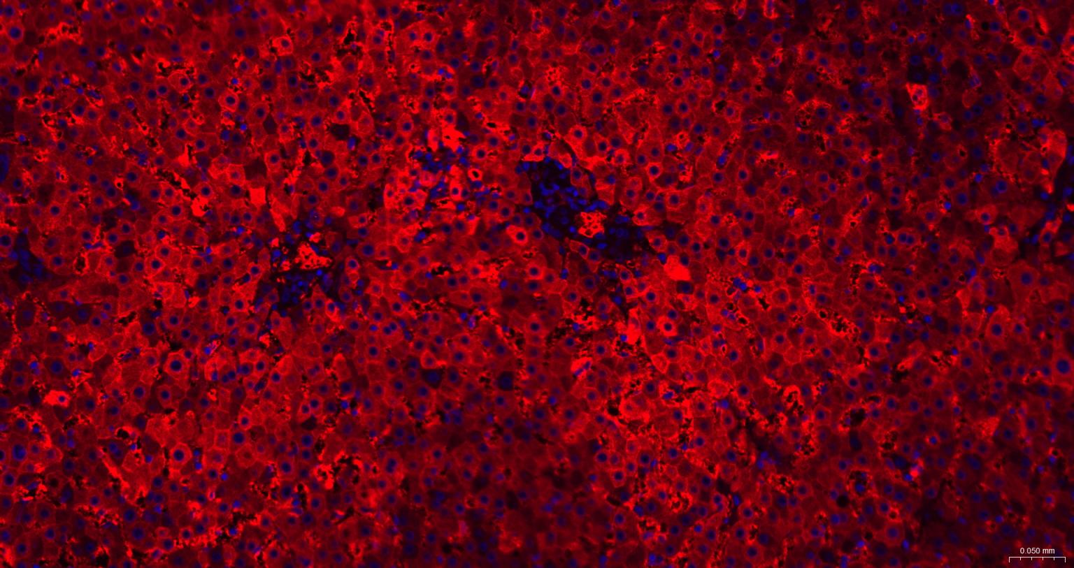 铁蛋白重组兔单抗