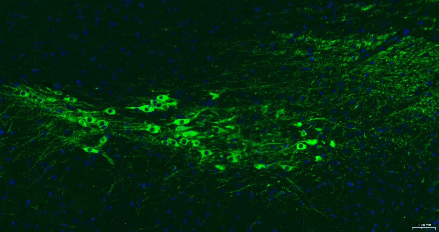 酪氨酸羟化酶兔单克隆抗体
