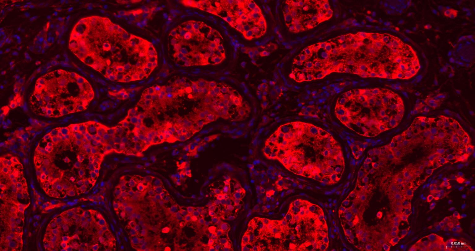 铁蛋白重组兔单抗