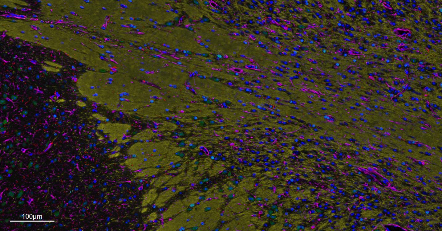 髓鞘碱性蛋白/磷脂碱性蛋白单克隆抗体-bsm-33932M