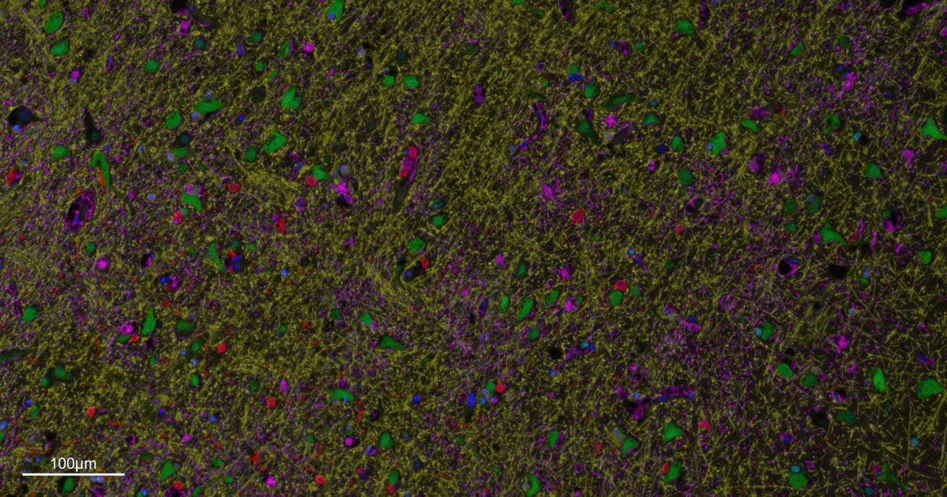 胶质纤维酸性蛋白重组兔单抗