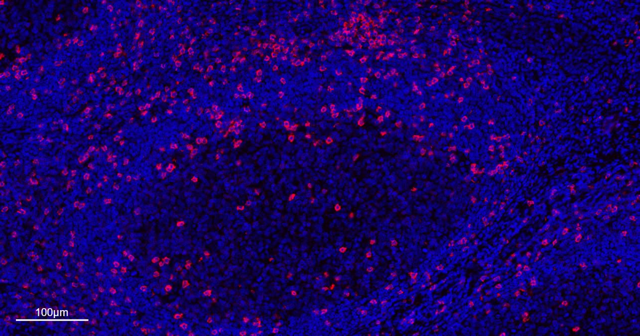 CD8A单克隆抗体-bsm-34251M