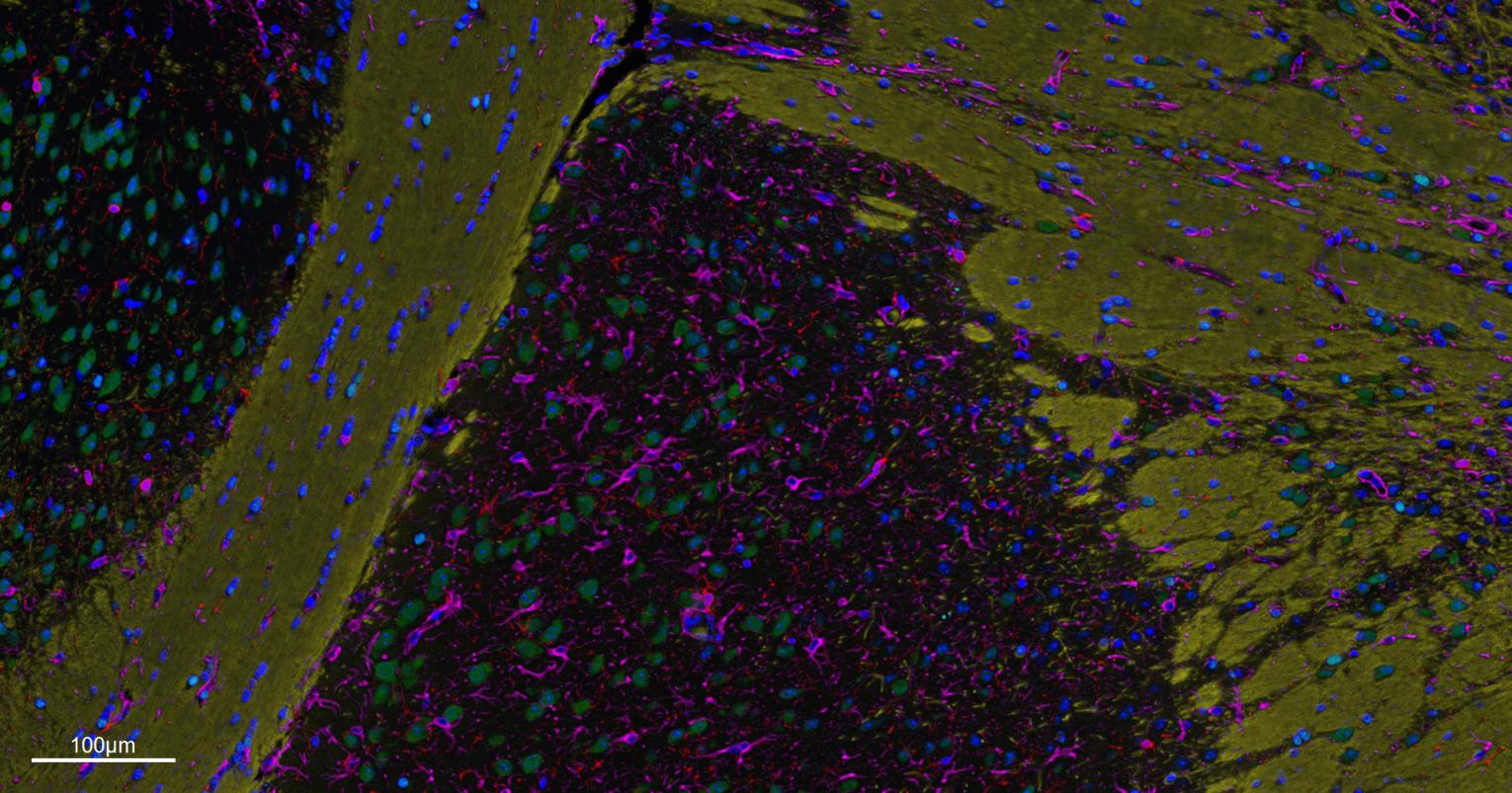 胶质纤维酸性蛋白重组兔单抗