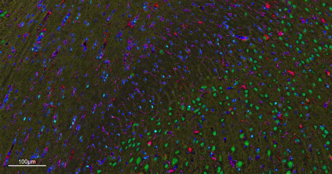少突胶质细胞转录因子2重组兔单抗