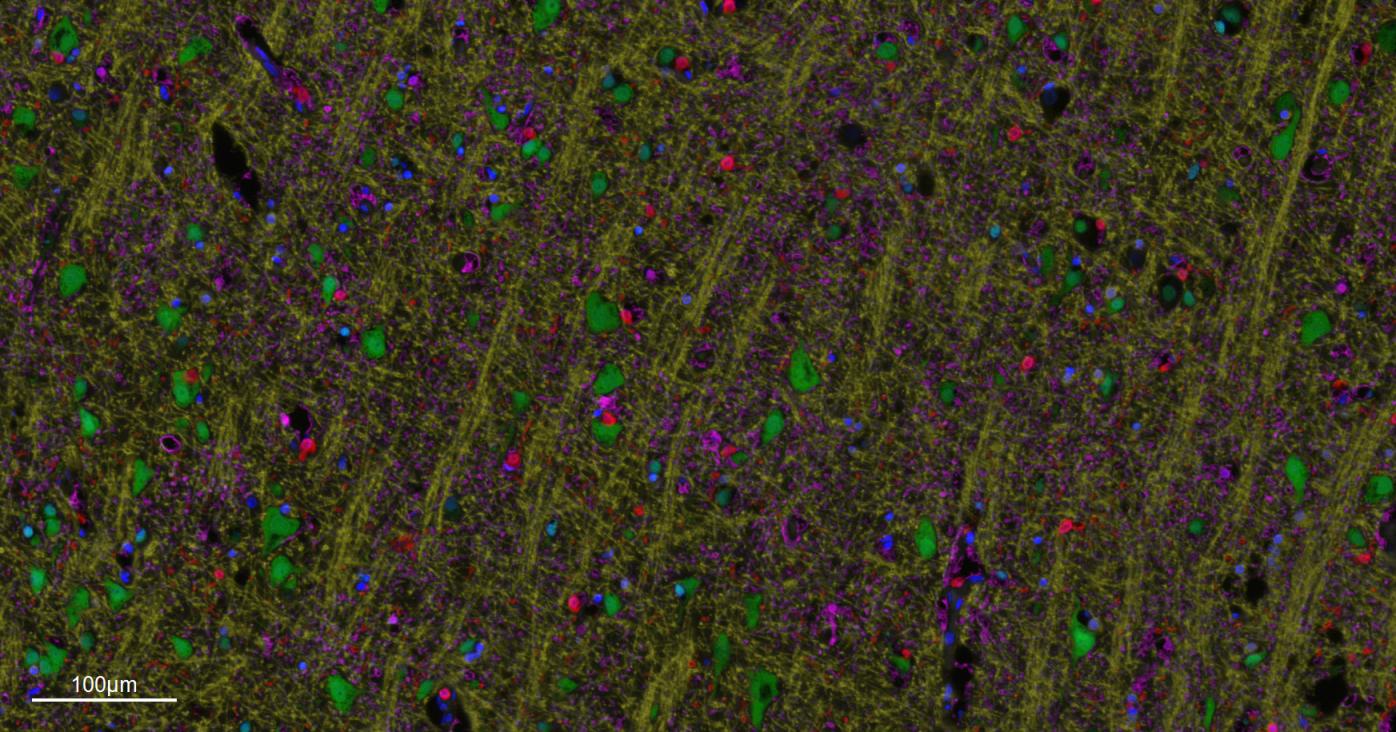 髓鞘碱性蛋白/磷脂碱性蛋白单克隆抗体-bsm-33932M