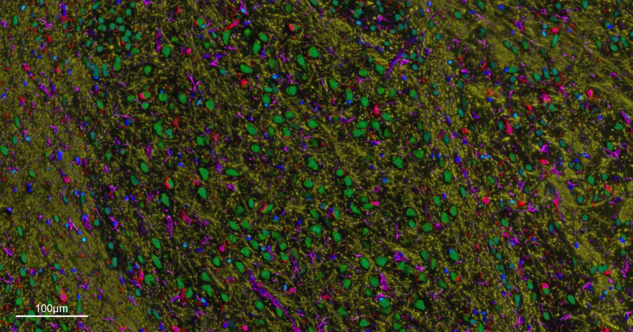神经元核抗原重组兔单抗