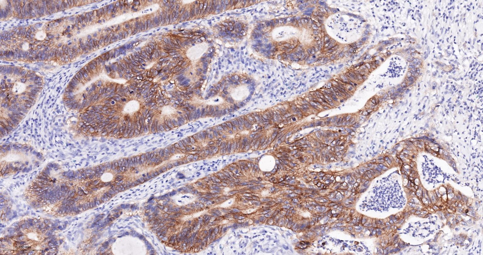 上皮特异性抗原（CD326）重组兔单克隆抗体