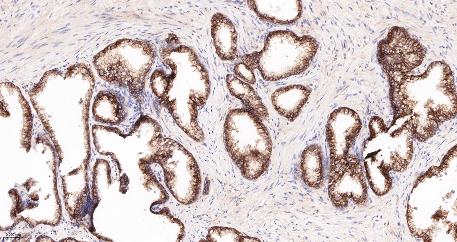 上皮特异性抗原（CD326）重组兔单克隆抗体