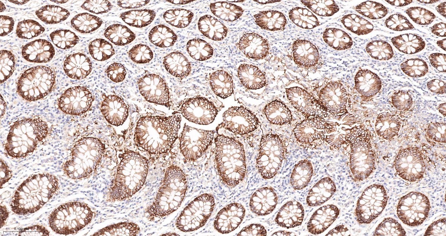 上皮特异性抗原（CD326）重组兔单克隆抗体