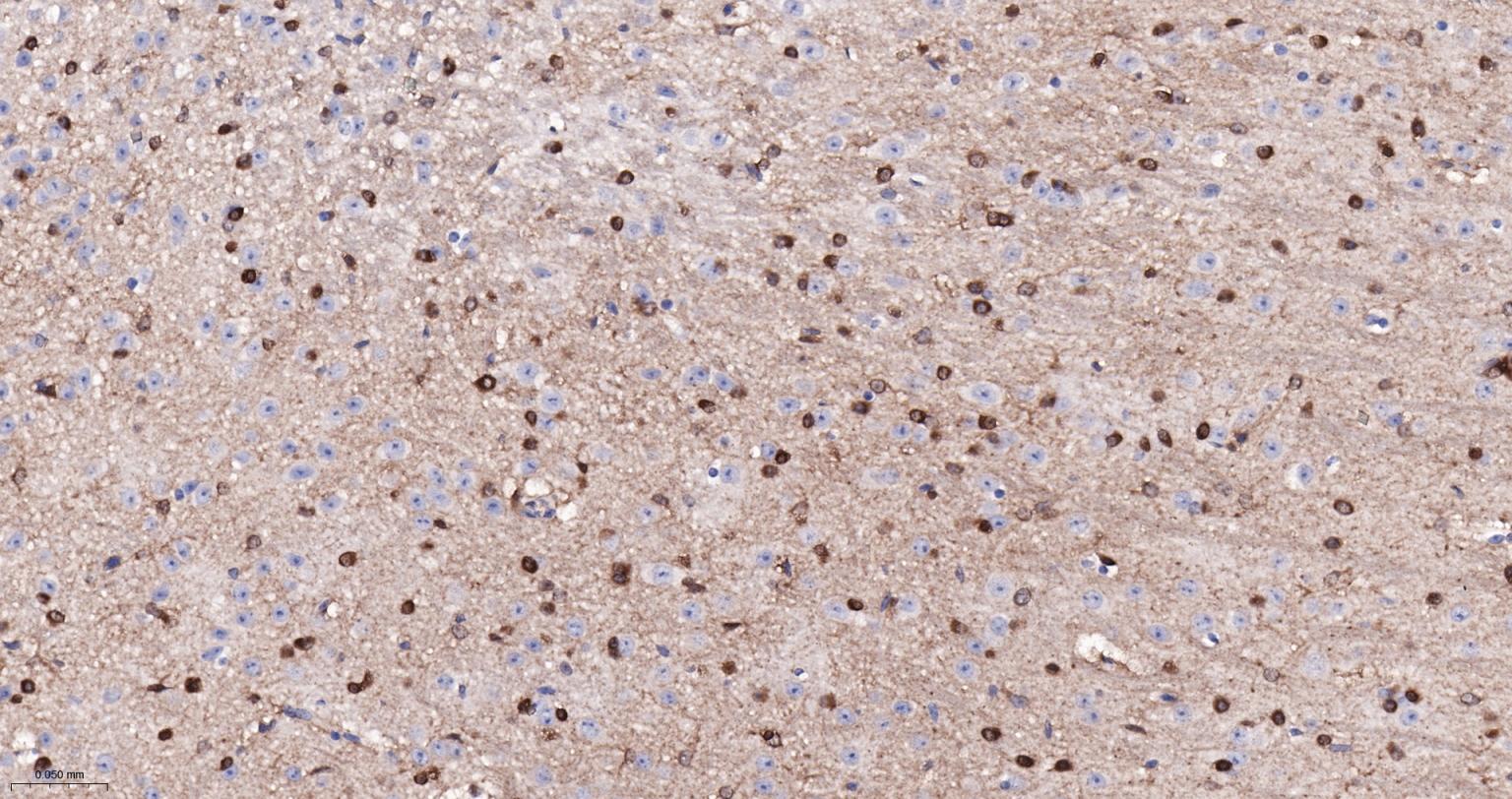 脑源神经营养因子重组兔单抗