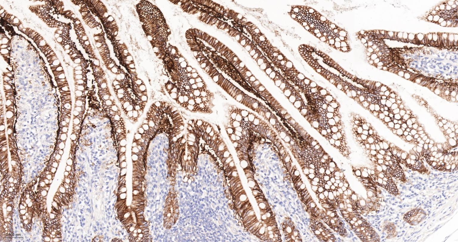 上皮特异性抗原（CD326）重组兔单克隆抗体