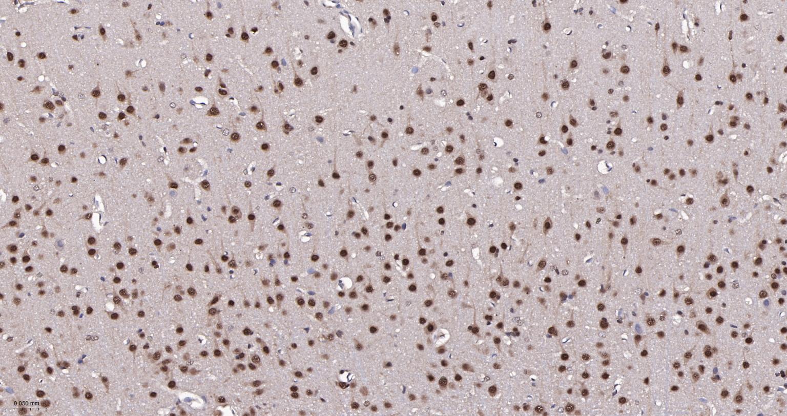 泛素蛋白(K48-linkage)重组兔单抗