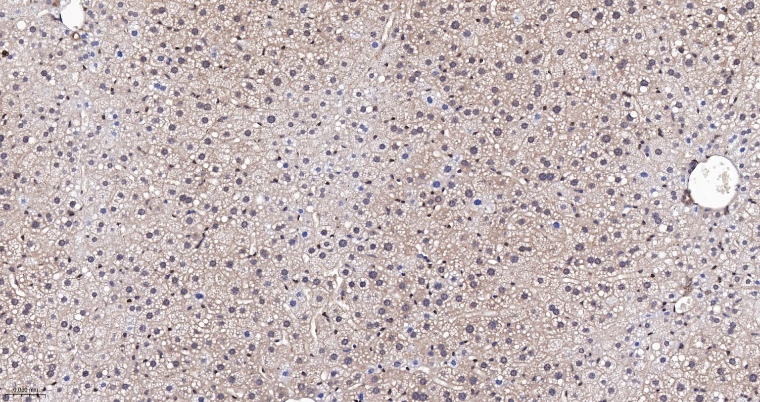 泛素蛋白(K48-linkage)重组兔单抗