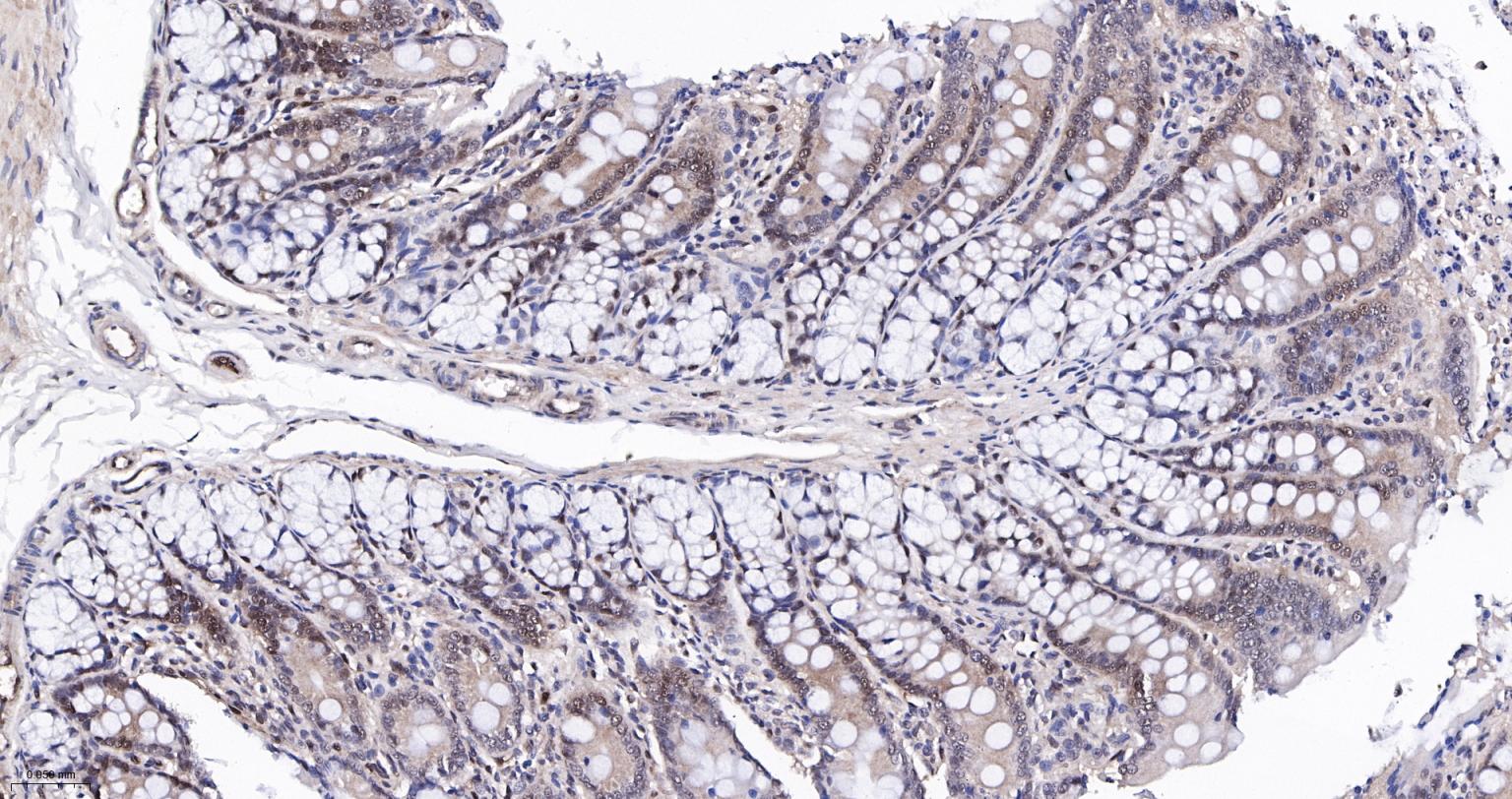 泛素蛋白(K48-linkage)重组兔单抗