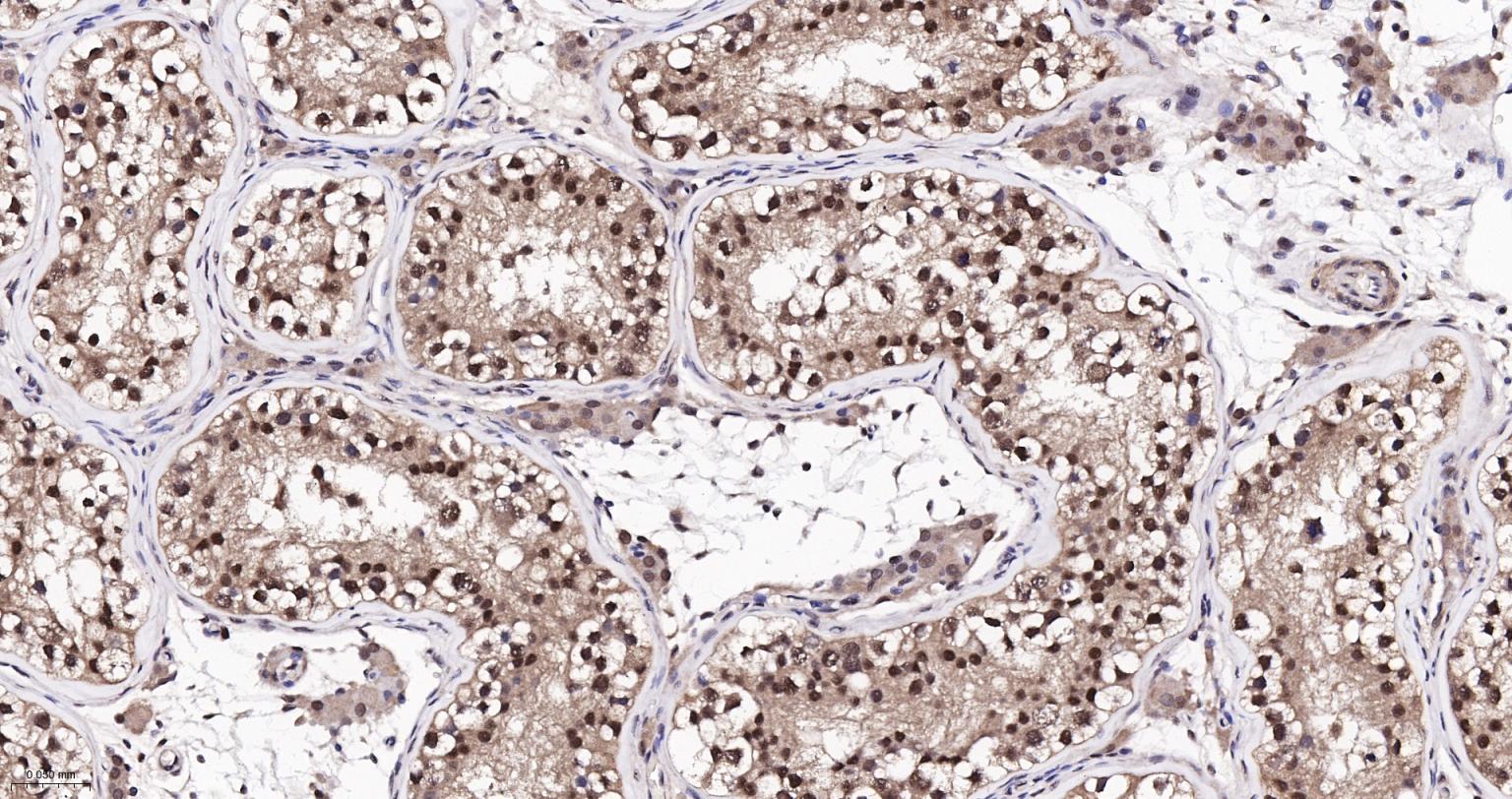 泛素蛋白(K48-linkage)重组兔单抗