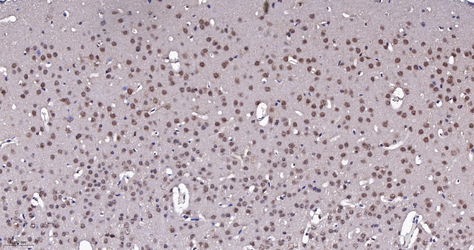 泛素蛋白(K48-linkage)重组兔单抗