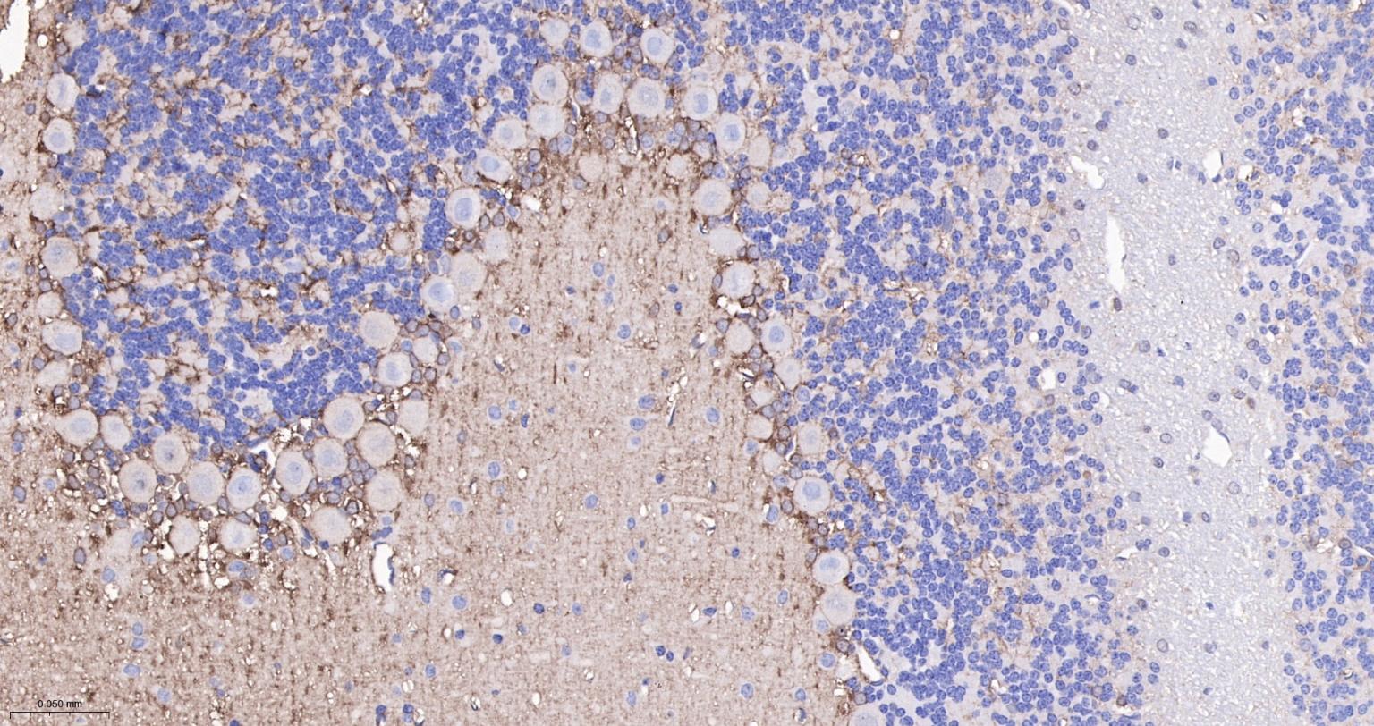 脑源神经营养因子重组兔单抗