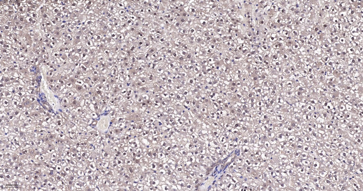 泛素蛋白(K48-linkage)重组兔单抗