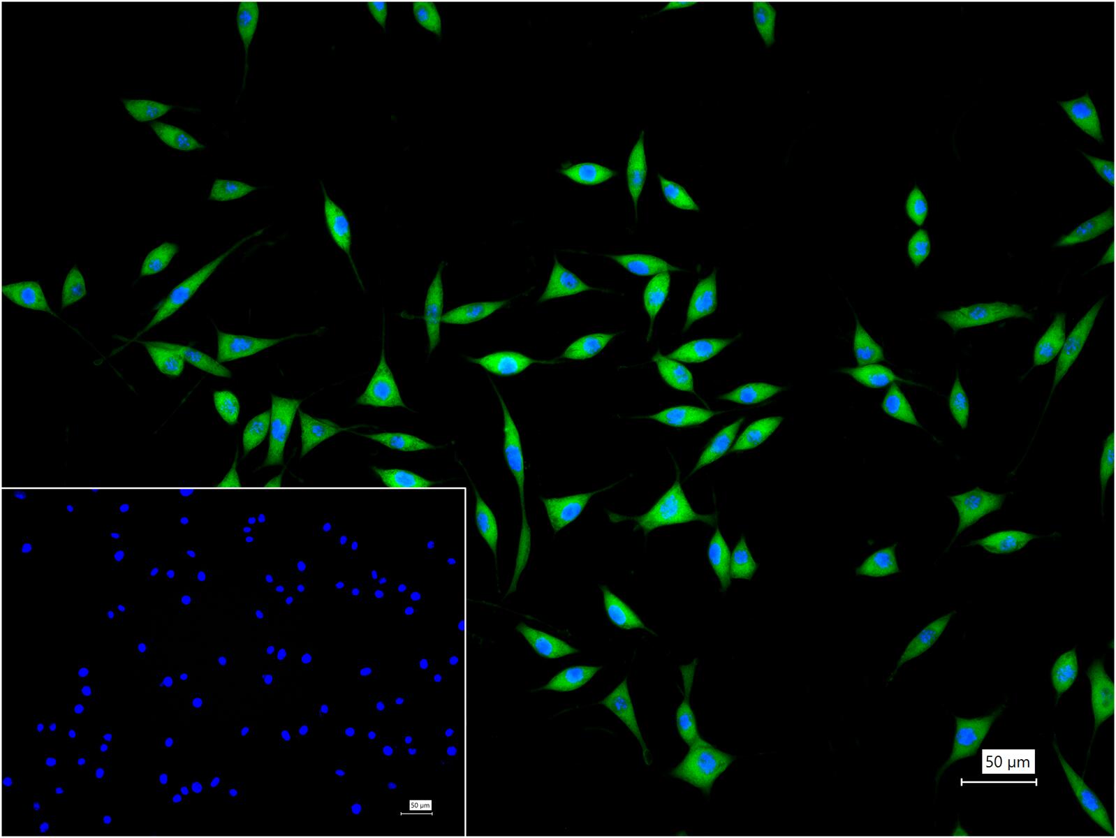 蛋白激酶C α重组兔单抗